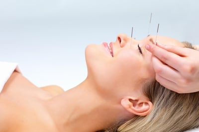 How is Acupuncture Treatment Done?
