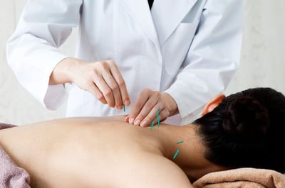 Pain Treatments With Acupuncture