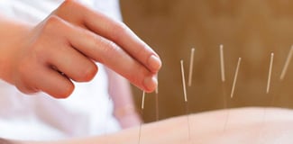 L'acupuncture
